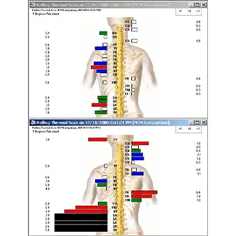 neuro scan and chiropractic in Corte Madera