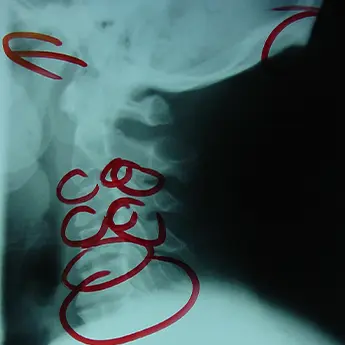 xrays and chiropractic in Corte Madera
